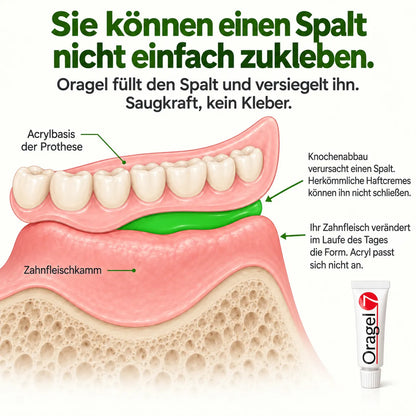 FREE Denture Hold Guide eBook